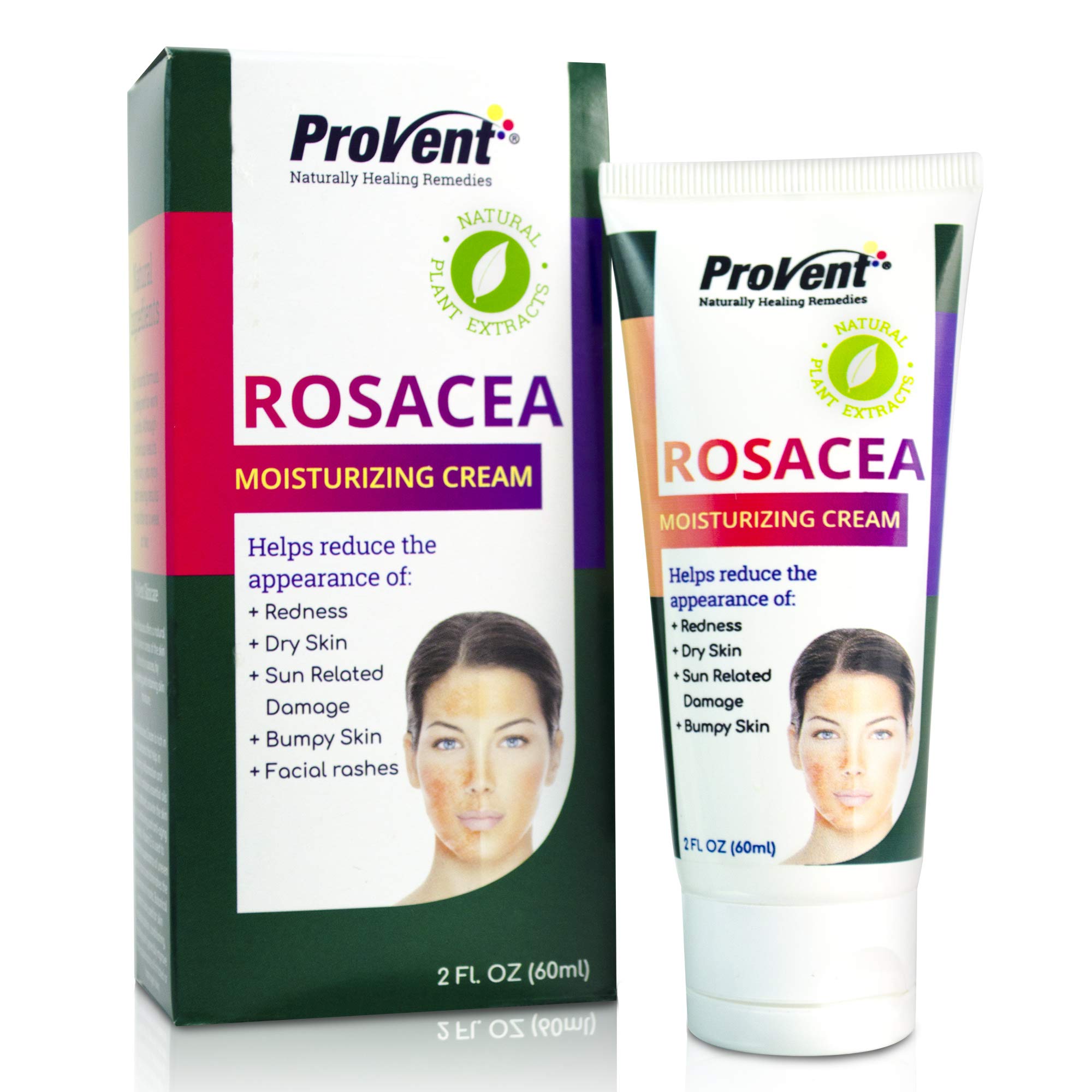 rosacea moisturizing cream