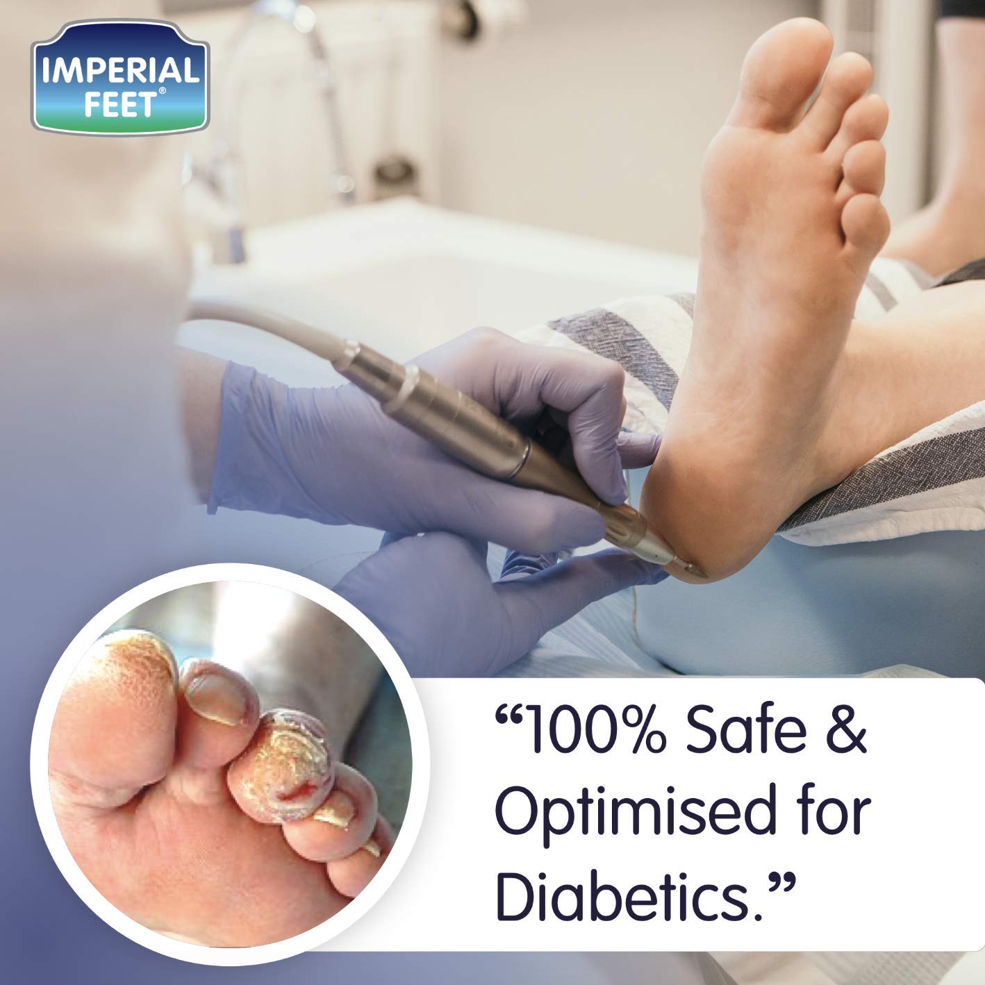 imperial feet corns and calluses