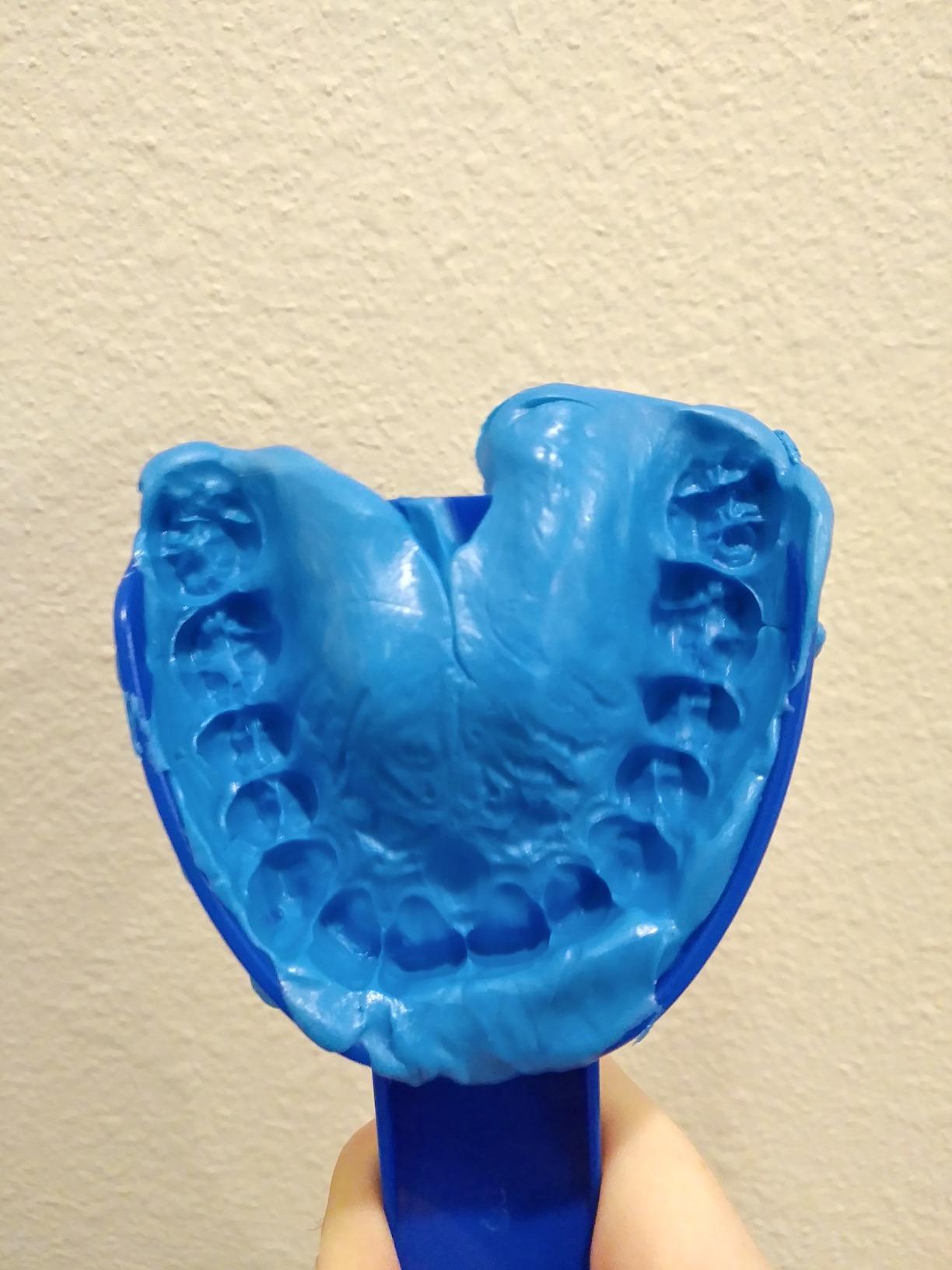 5/mo Finance Custom Grillz Mold Kit Teeth Dental Impression Kit w