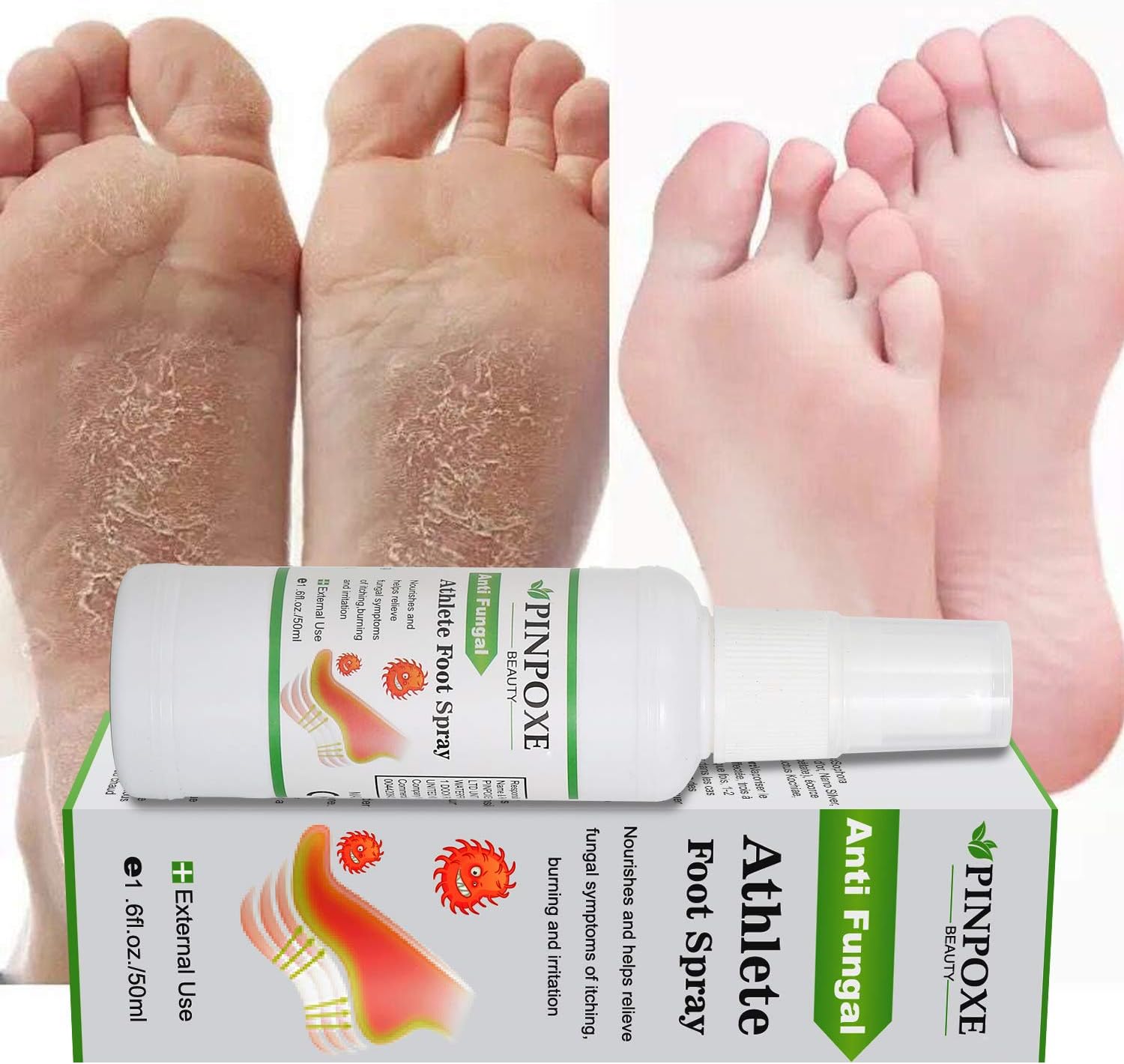 Foot Spray, Natural formula, Athletes Foot, Ringworm, Jock Itch and Foot Infections. Effectively Soothes in Minutes-Fights Against: Health & Personal Care