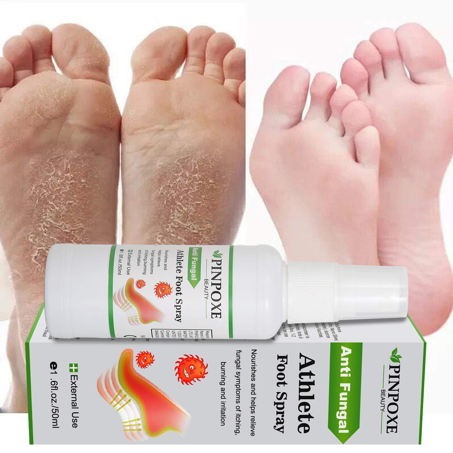 Foot Spray, Natural formula, Athletes Foot, Ringworm, Jock Itch and Foot Infections. Effectively