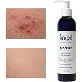 Nufree finipil Pro After Hair Removal Ingrown Hair Treatment Cream, 8 Oz | Post-shave Treatment Razor Bumps After Waxing Soothing Skin Reduces Redness