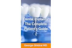 Dental Implants: The Complete Patient's Guide