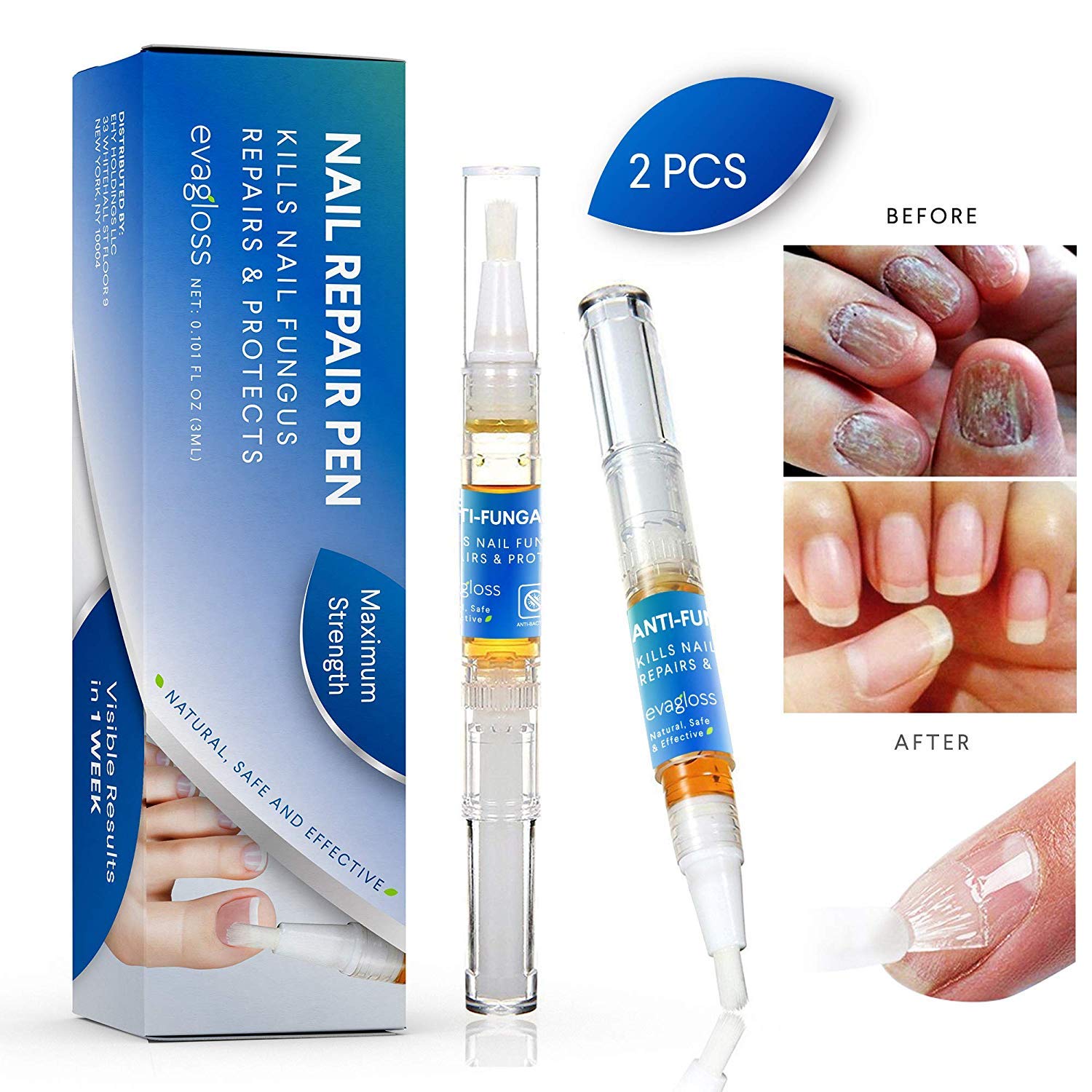 Fungus Stop, Anti fungal Nail Solution Kills Fungus on Toenails & Fingernails, Solution