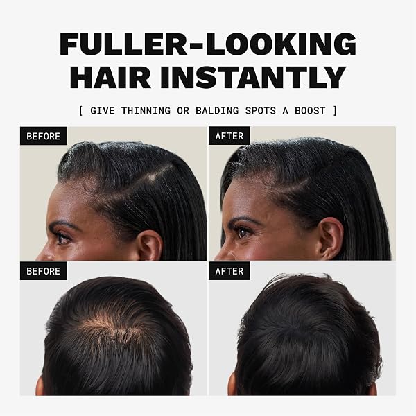 TOPPIK HAIR BUILDING FIBERS, WHITE, 12G FILL IN FINE OR THINNING HAIR, INSTANTLY THICKER, FULLER LOOKING, 9 SHADES FOR MEN & WOMEN, KERATIN PROTEIN FORMULA