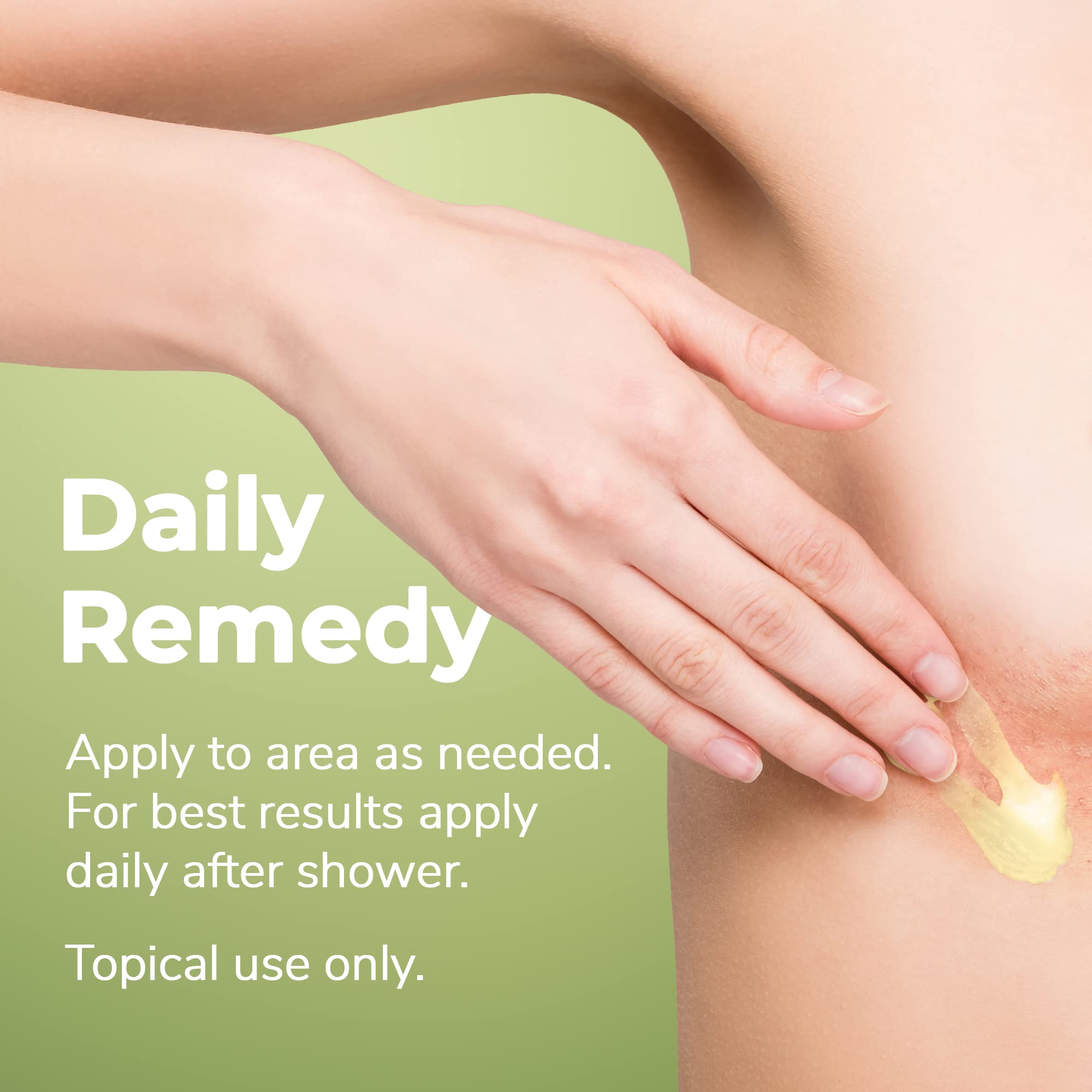 Under Breast and Cleavage Rash Cream, Breast Chafing, Itch Relief, Chafing Relief, Made with Matcha Green Tea and Pure Essential Oils, 1 oz.