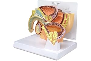 GPI Anatomicals - Human Anatomy Model of Male Pelvis with Benign Prostatic Hyperplasia (BPH), Replica for Anatomy, Physiology Education, Anatomy Model for Doctor's Office, Medical Learning Resources