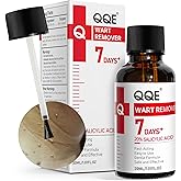 QQE 20% Salicylic Acid Wart Remover Liquid, Zero Pain Wart Remover for Plantar, Common, Flat Wart, Foot Corn for Multiple Parts of Body (Pack of 1)