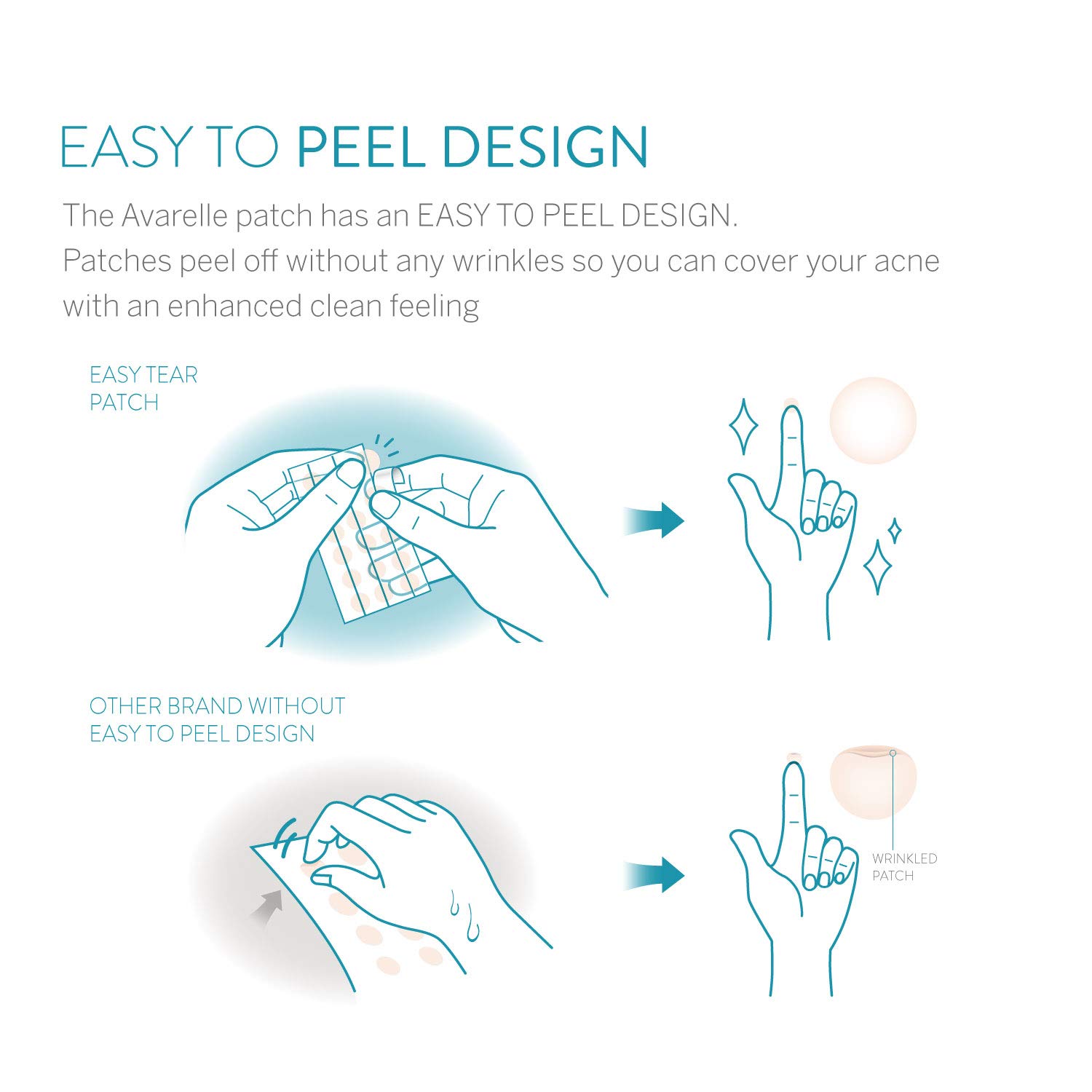 Avarelle Acne Absorbing Cover Patch Hydrocolloid Spot Treatment with Tea Tree Oil, Calendula Oil and Cica, Vegan, Cruelty Free Certified (40 Count): Beauty