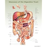 Diseases of the Digestive Tract Anatomical Chart