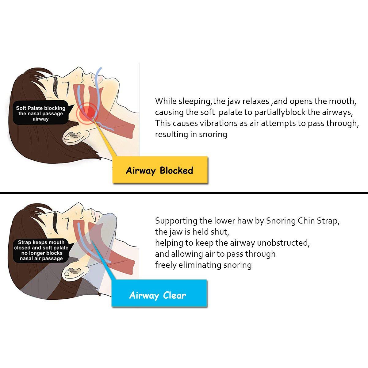 Boxalls Snore Chin Strap,Adjustable Anti-Snoring Jaw Chin Strap Stop Snoring Strap for Women Men (Black)