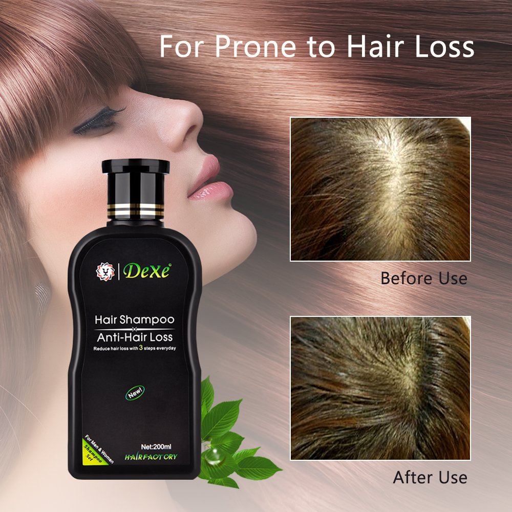 Hair Growth Stimulating Shampoo Anti-Hair Loss Hair Shampoo Thinning Hair Treatment - For men & women 200ML: Beauty
