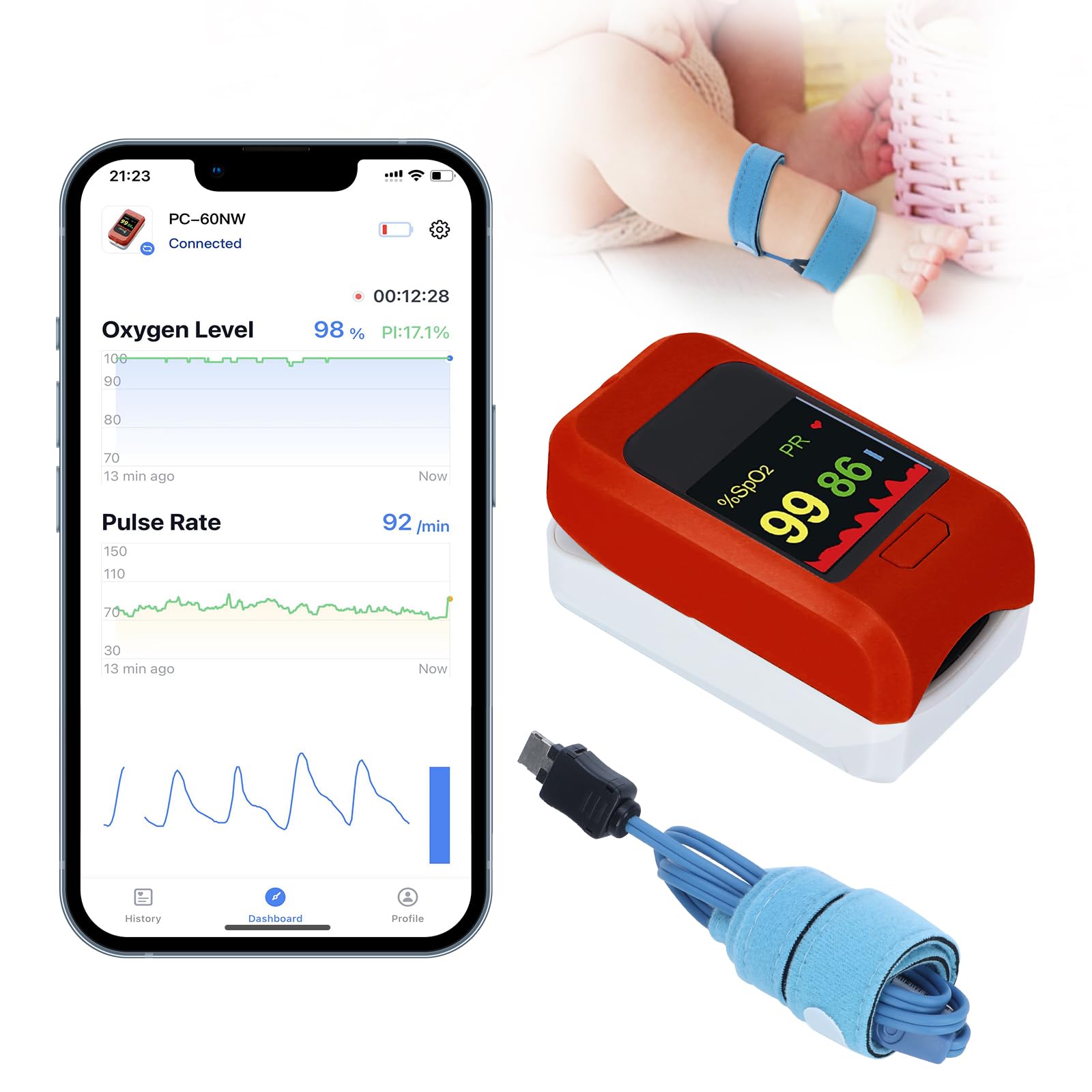 Baby Oxygen Monitor with Bluetooth App, Baby Pulse Oximeter, Tracks ...