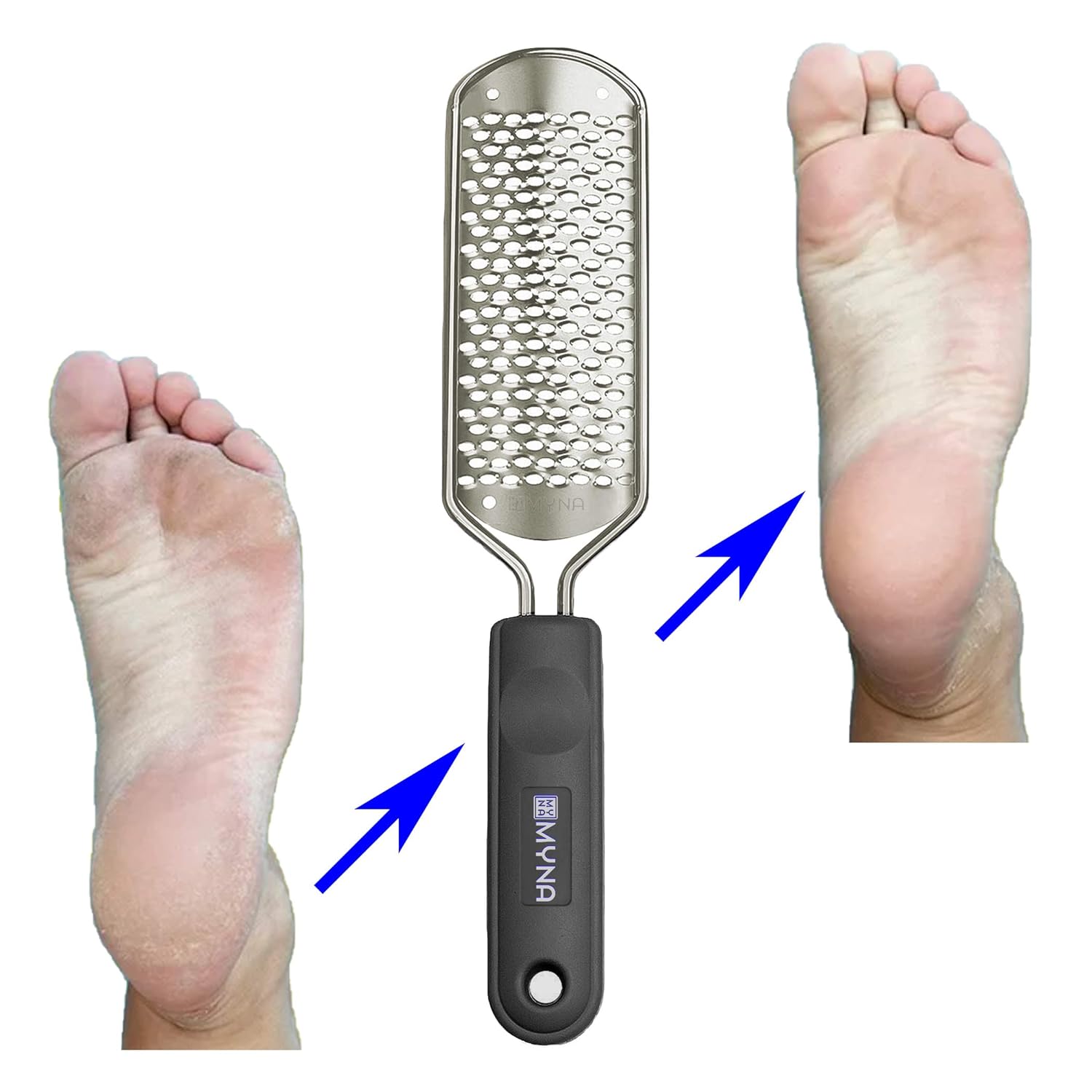 Stainless Steel Callus Remover Foot File Colossal Foot Scraper Foot Scrubber for pedicure kit professional Foot spa and Dead Skin Cracked Skin Corns Removal with Extra Blade Replacement - MyNa (Black) : Beauty