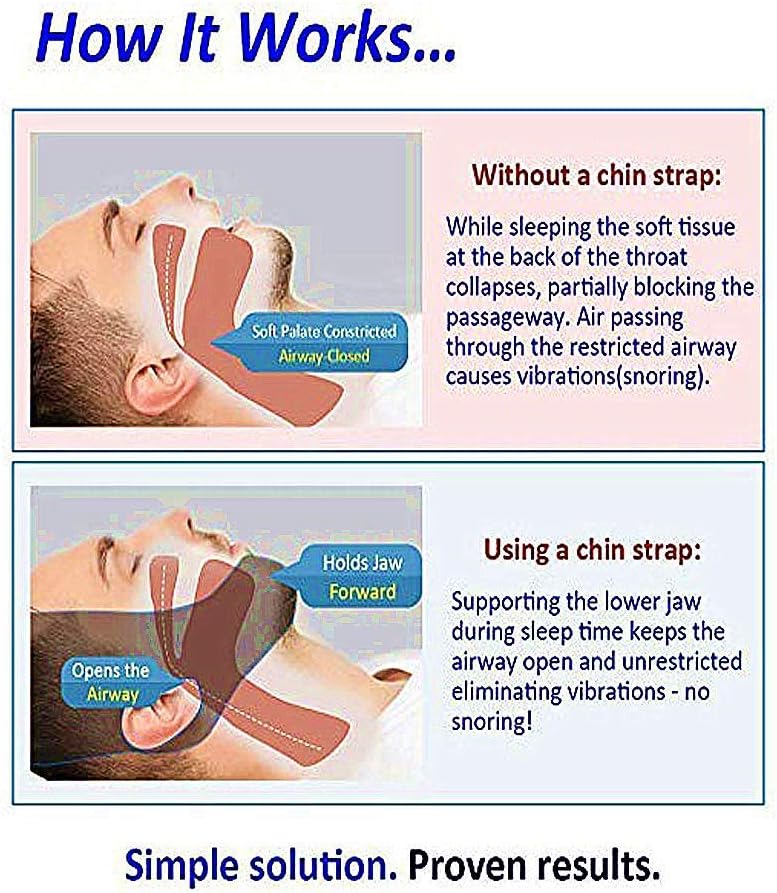 Anti Snore Snoring Chin Strap Devices for Men Women Kids, Anti Snoring Snore Chin Strap Large Bangbreak Duzel, Anti My Snoring Snore Solution, Resmed Cpap Supplies Chin Straps: Health & Personal Care