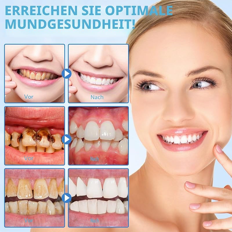 Hydroxylapatit Zahnpasta 2er-Pack, Fluoridfreie 9.9% Nano Hydroxylapatit Zahnpasta, Hilft bei der Remineralisierung, Schützt den Zahnschmelz, Lindert Empfindlichkeit, Stärkt die Zähne, Mundpflege