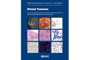 Breast Tumours: WHO Classification of Tumours (Volume 2)