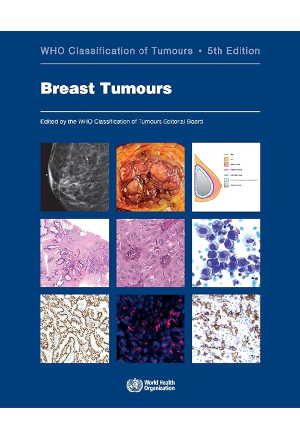Thoracic Tumours: WHO Classification of Tumours: 9789283245063