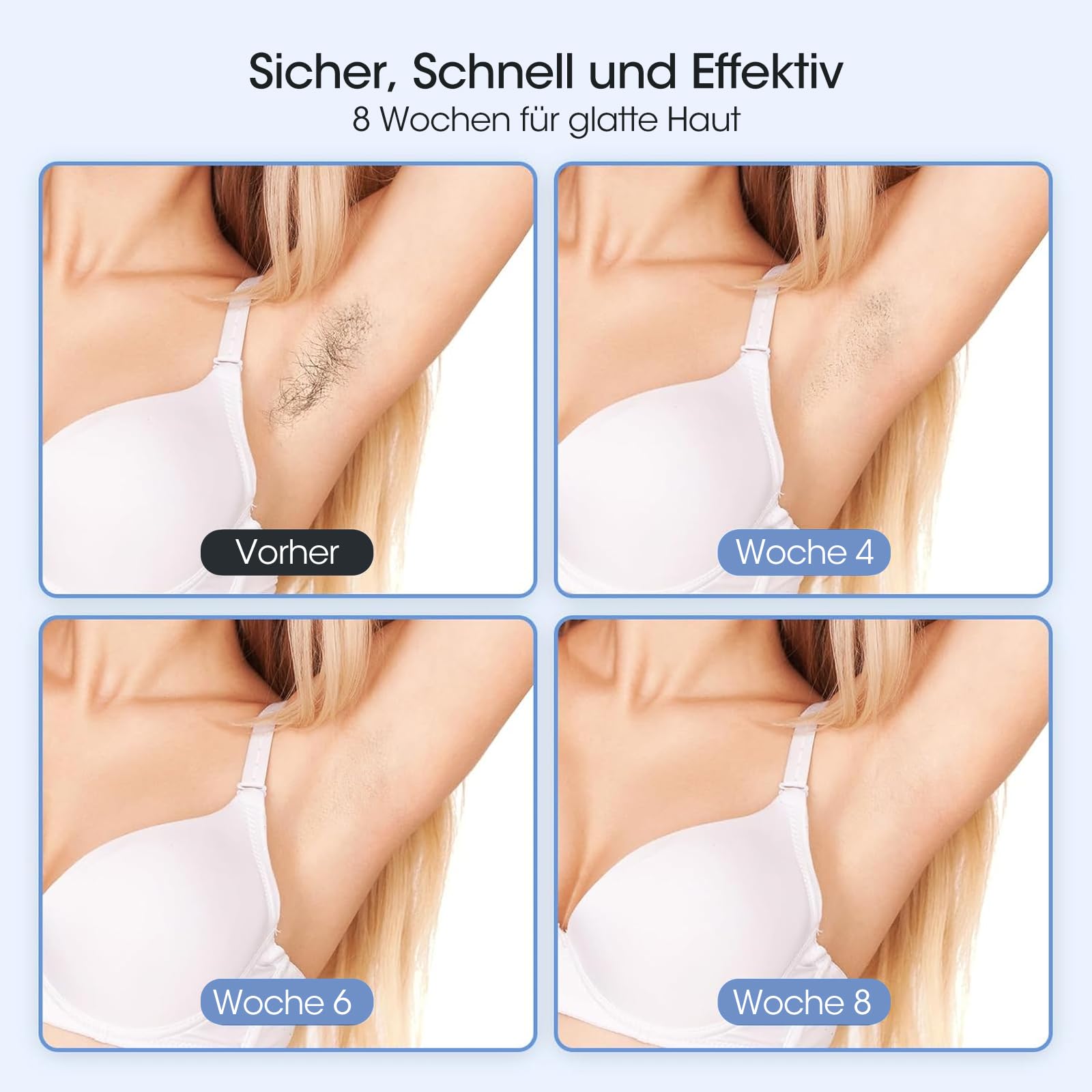 MLAY IPL Laser Haarentfernung zuhause, 0,5 Sek./Impuls, schmerzfreie Haarentfernung mit Kühlung, zwei Präzisionsköpfen, Männer und Frauen geeignet für Gesicht, Achselhöhlen, Beine und Bikinizone 6