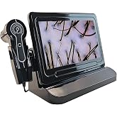 Yopchill Scalp and Hair Follicle Analyzer, 11-Inch HD Display Digital Microscope Camera with 50X &amp; 200X Dual Lenses, Skin and Hair Condition Magnifier for Salon Professionals and Home Use
