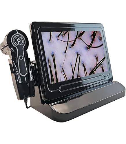 Amazon.com : Scalp Detector, 13inch 50X/200X Lens Multi‑Functional