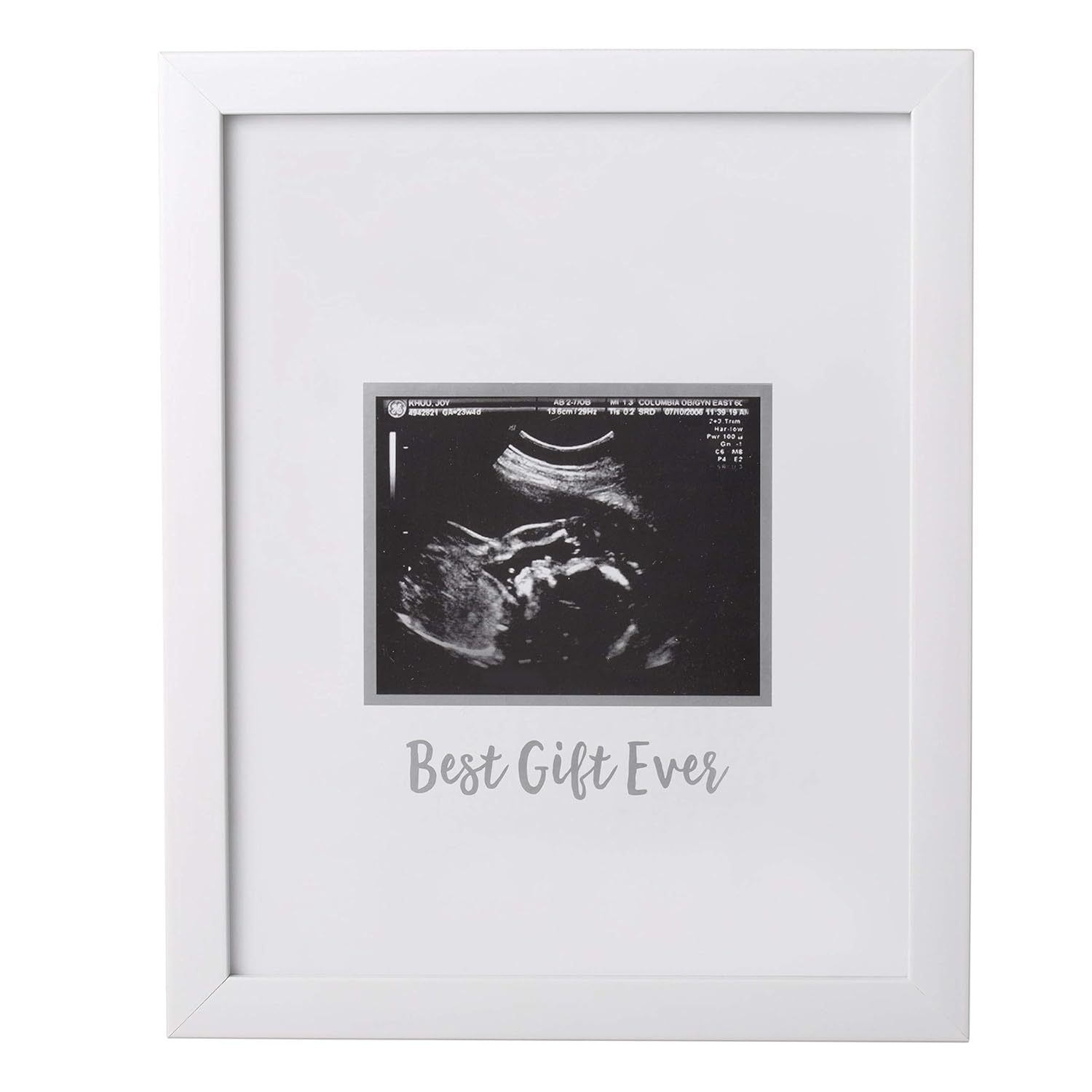 baby scan personalised gifts