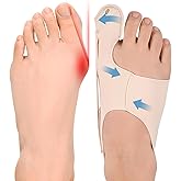 Yiciwoc Bunion Corrector,Adjustable Toe Straightener for Pain Relief,Bunion Corrector & Big Toe Alignment Splint,Day & Night Wear for Men and Women,Fits in Most Shoes for Daily Activities(Large)