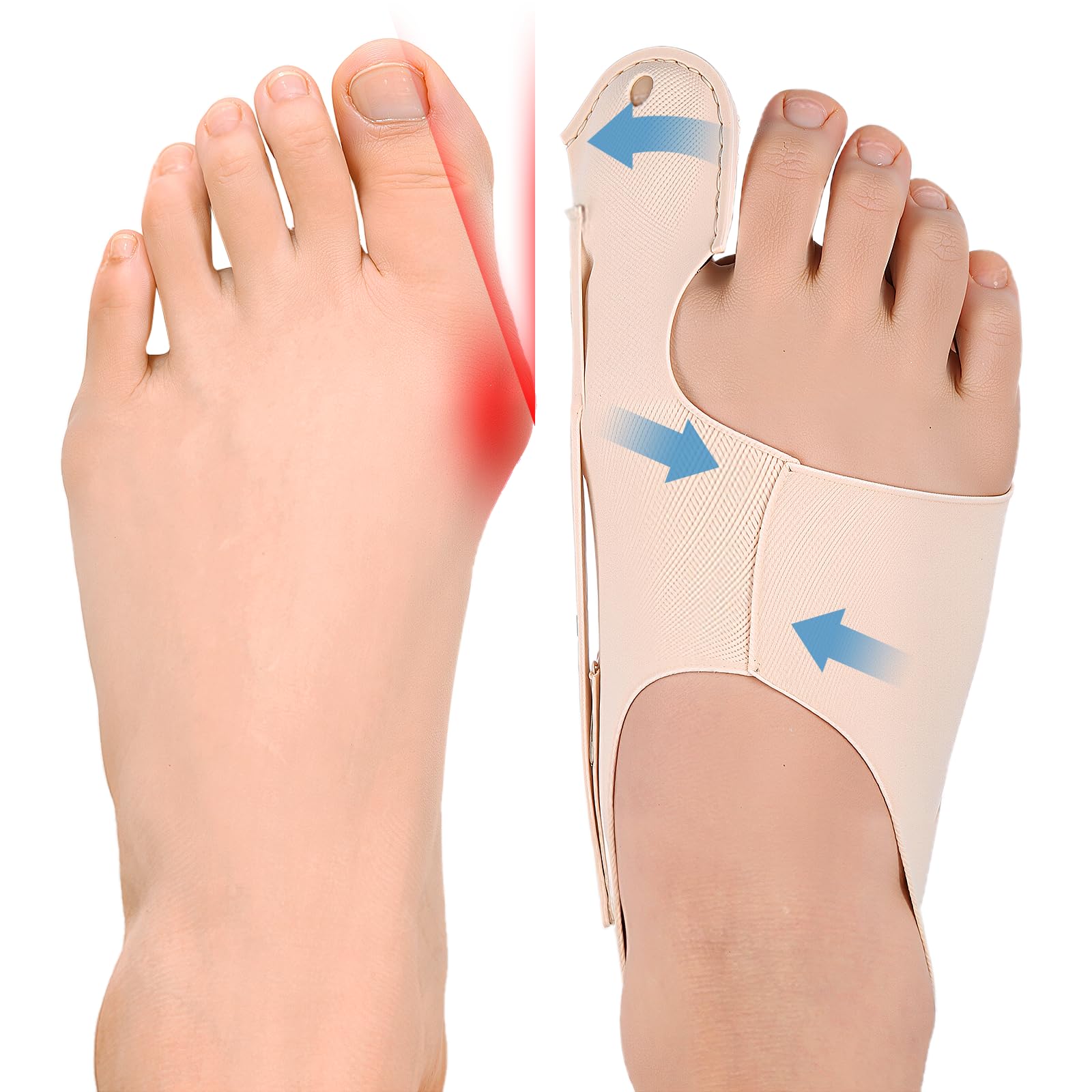 Photo 1 of Yiciwoc Bunion Corrector,Adjustable Toe Straightener for Pain Relief,Bunion Corrector & Big Toe Alignment Splint,Day & Night Wear for Men and Women,Fits in Most Shoes for Daily Activities(Large)