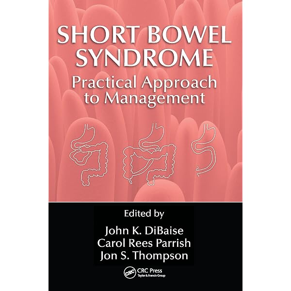 Short Bowel Syndrome: Practical Approach to Management: DiBaise