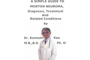 A Simple Guide To Morton Neuroma, Diagnosis, Treatment And Related Conditions (A Simple Guide to Medical Conditions)