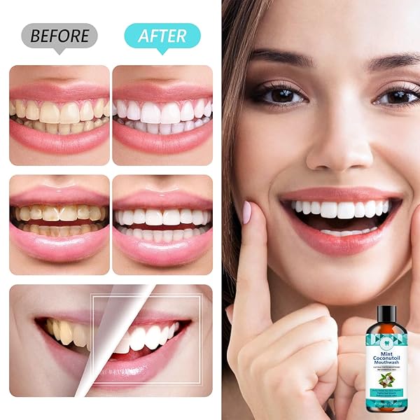 500ML COCONUTOIL MOUTHWASH, NATURAL TEETH WHITENER WITH TONGUE SCRAPER – MINT FLAVOR FOR FRESH BREATH, ORAL CARE AND GUM HEALTH