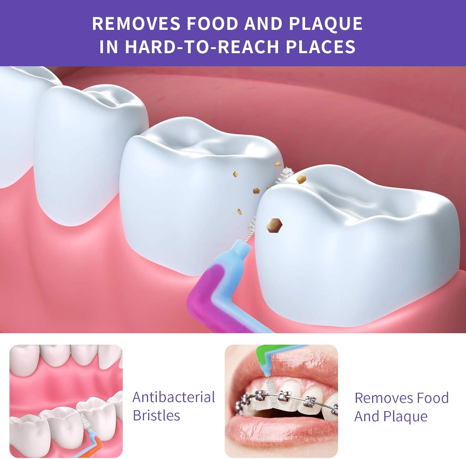 Interdental Brushes Angle Cleaners, Hartilv Braces Angle Brush Cleaner Between Teeth Cleaning Tool with Soft Bristles for Deep Clean Between Teeth and Gums (0.6mm)10pcs: Health & Personal Care