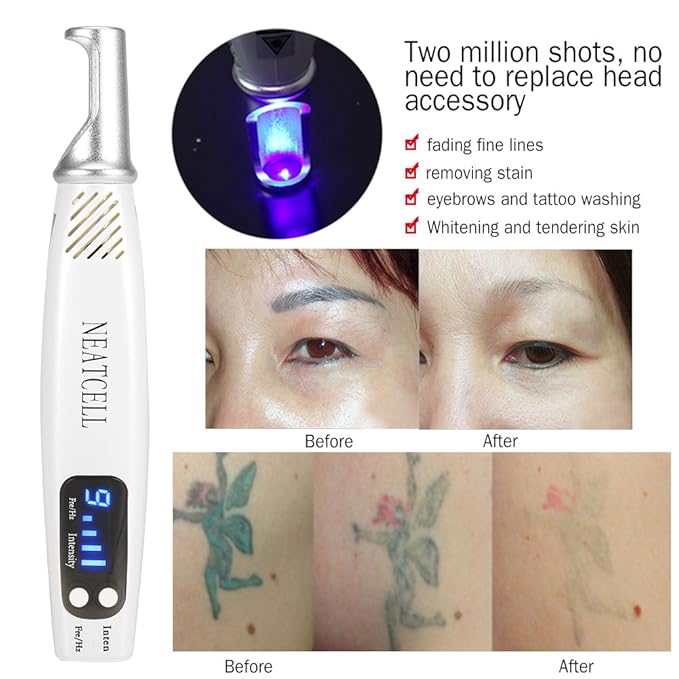 Długopis do usuwania plam Picosekond Pikosekund, terapia ...