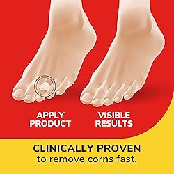 Dr. Scholl's Corn Removers with Hydrogel, 6 ct