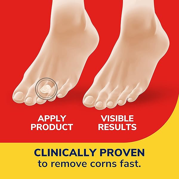 DR. SCHOLL’S CORN REMOVERS SEAL & HEAL BANDAGE WITH HYDROGEL TECHNOLOGY, 6 CT // REMOVES CORNS FAST AND PROVIDES CUSHIONING PROTECTION AGAINST SHOE PRESSURE AND FRICTION FOR ALL-DAY PAIN RELIEF