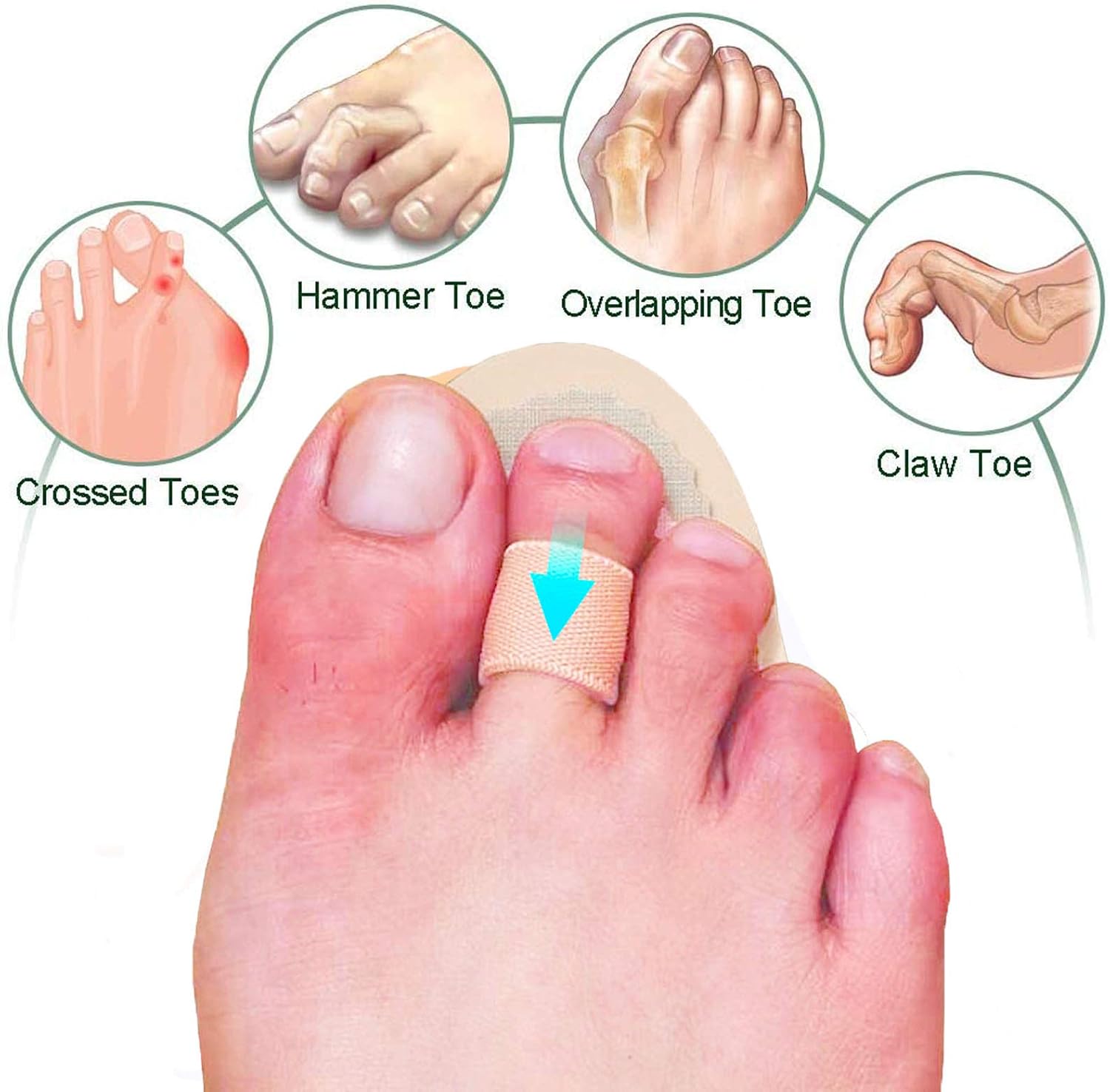 Mcvcoyh Adjustable 2 Loops Toe Splint, Hammer Toe Cushion for Toe Claw Curled & Crooked Toes - Support Guard Protector for PrePost - Image 4