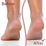 Finishing Touch Flawless Pedi Electric Callus Remover, Rechargeable view 4