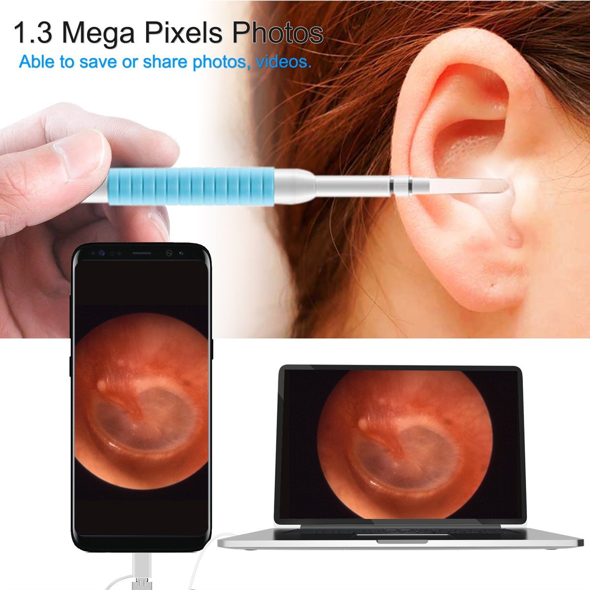 USB Endoscope Camera, Chof 720P HD Ear Otoscope Inspection, 3 in 1 Microscope Ear Wax Tool with 6 Bright Lights for Android Devices, PC, 6.5ft