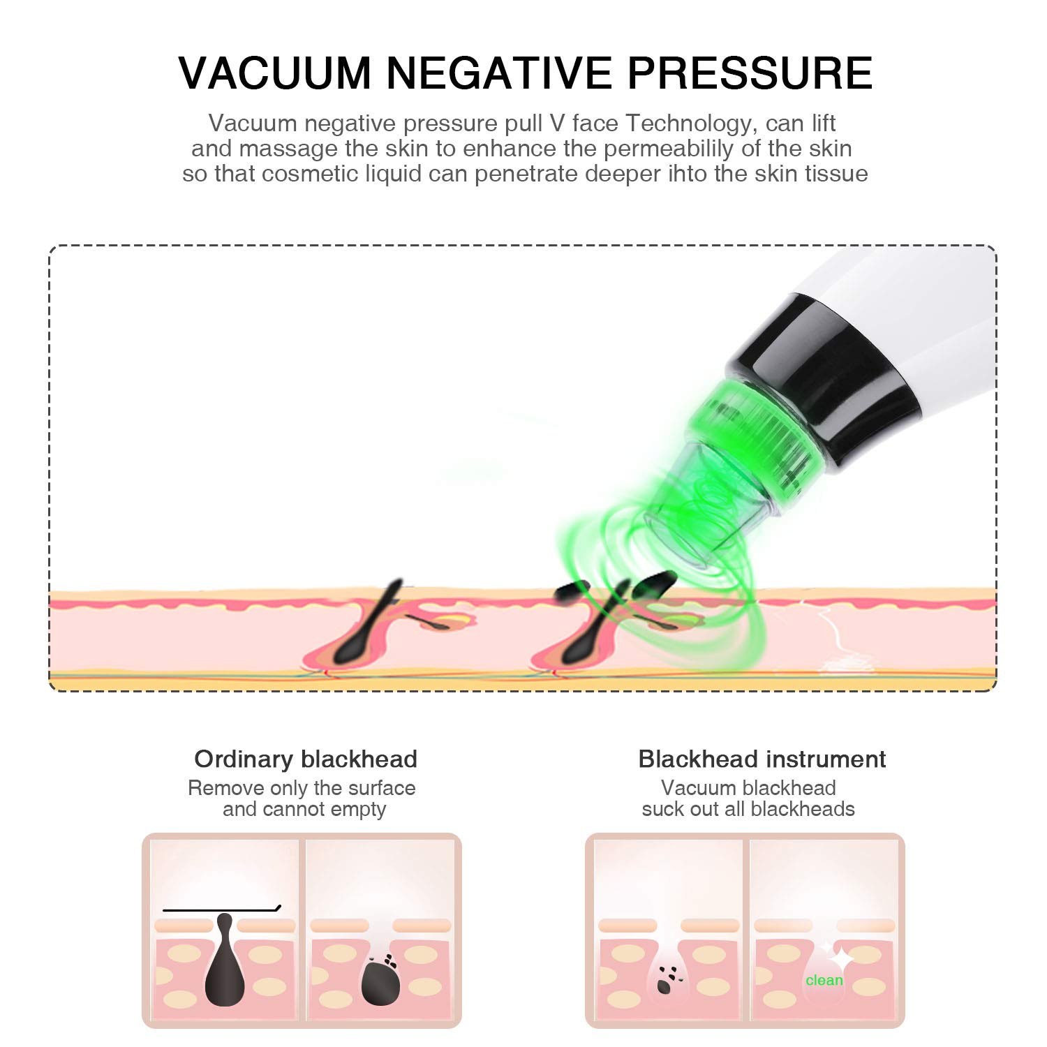 Blackhead Remover Pore Vacuum, Electric Blackhead Vacuum Suction Tool Set Skin Facial Pore Cleaner, Acne Comedo Eliminator Blackhead Extractor Device for Women\'s Skin Care with 5 Multi-Functional Probe
