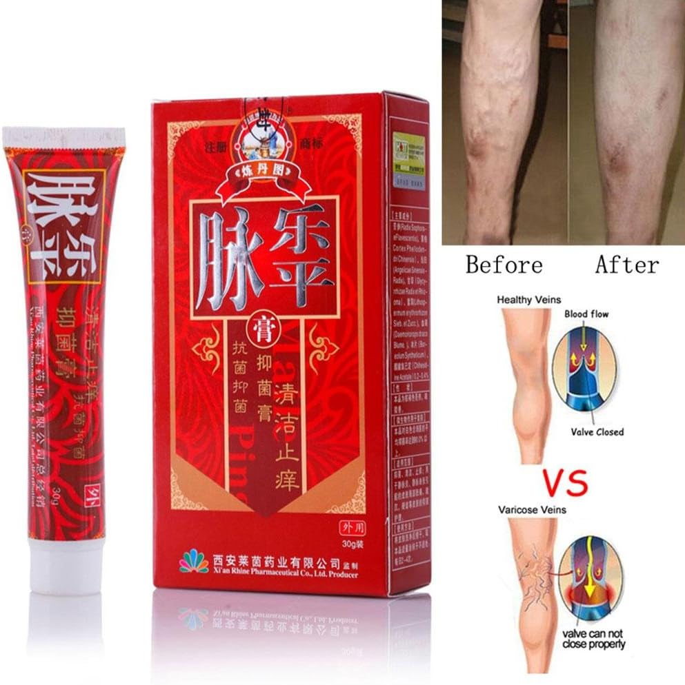 Varicose Veins Cream, leegoal Relief Phlebitis Vasculitis Angiitis Inflammation Blood Vessel Spider Vein Herbal Health Care Ointment (1 pcs)