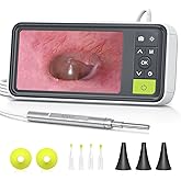Anykit Digital Otoscope with Gyroscope, 4.5 Inches Screen, 3.9mm Ear Scope Camera with 6 Lights, Ear Wax Removal Tool, 32GB C