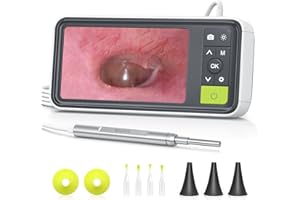 Anykit Digital Otoscope with Gyroscope, 4.5 Inches Screen, 3.9mm Ear Scope Camera with 6 Lights, Ear Wax Removal Tool, 32GB Card, Supports Photo Snap and Video Recording