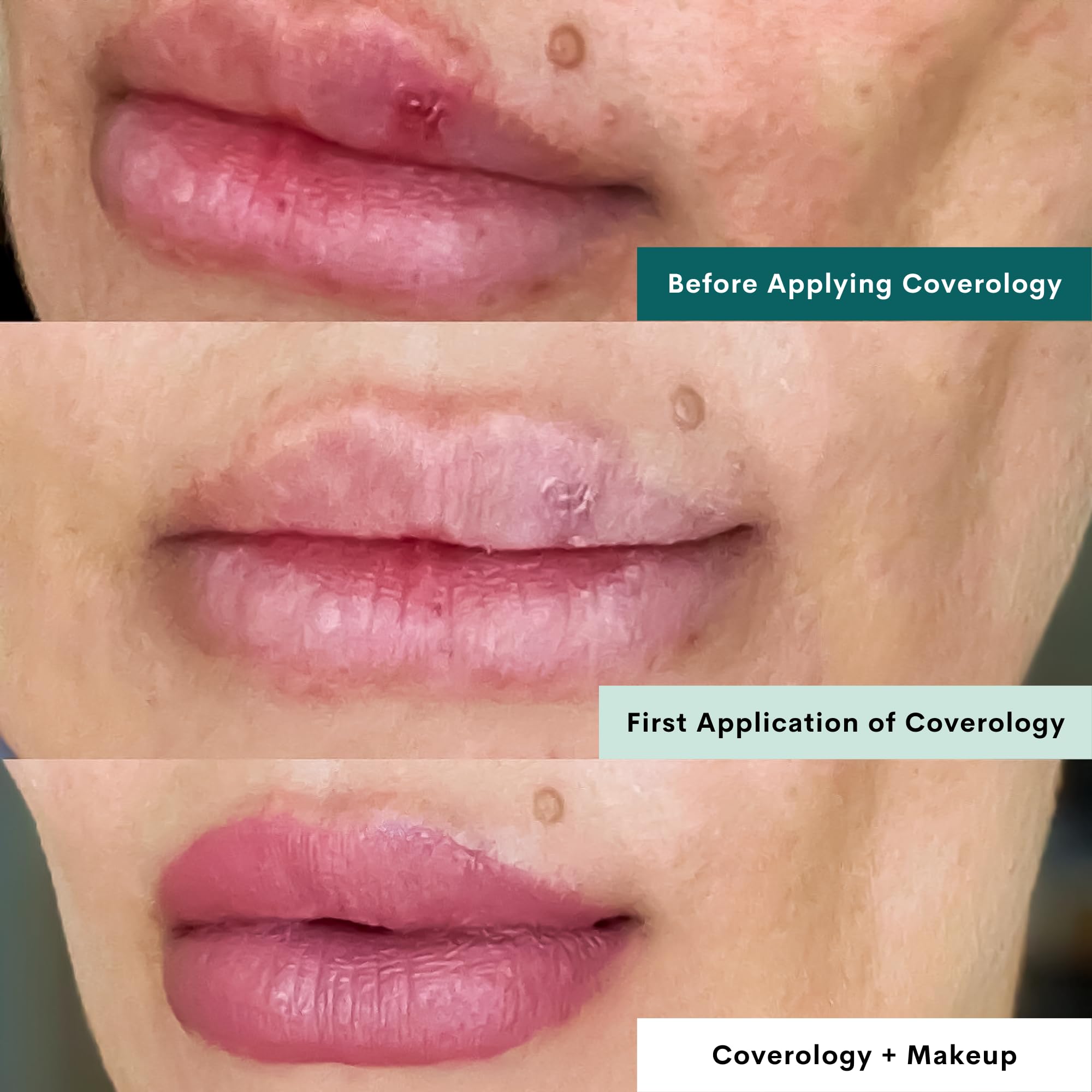 Coverology Cold Sore Makeup - Light with Applicator