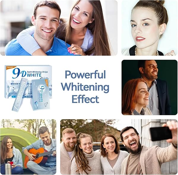 SOMALL 9D TEETH WHITENING STRIPS – 【NEWEST 2024】 PROFESSIONAL DENTAL FORMULA – ENAMEL SAFE WHITENING WITHOUT THE SENSITIVITY – 14 TREATMENTS WITH 28 STRIPS + MOUTHWASH GIVEN*14