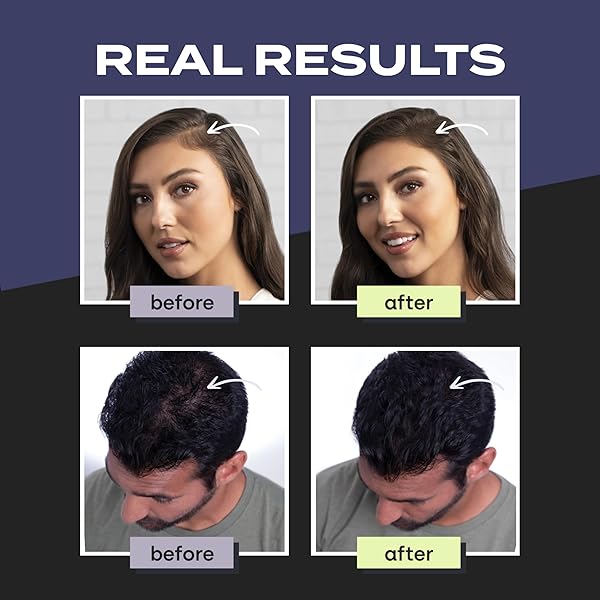 TOPPIK HAIR BUILDING FIBERS, BLACK, 12G FILL IN FINE OR THINNING HAIR INSTANTLY THICKER, FULLER LOOKING HAIR 9 SHADES FOR MEN WOMEN