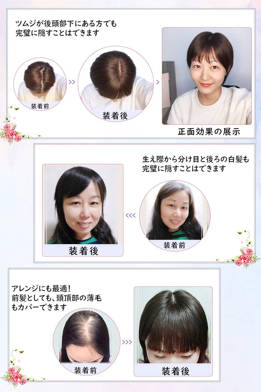Amazon Hiye 部分ウィッグ 人毛100 肌色人工頭皮 分け目自然 前髪付き トップカバー ストレート ヘアピース 医療用 円形脱毛症 薄毛 白髪隠し 抗菌 超軽量 ふんわり かつら 女性用 おしゃれ アレンジ 迫真 自然 ポイントウィッグ 通販