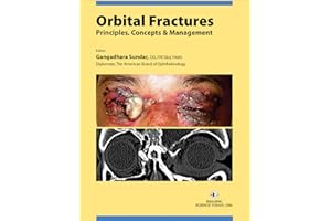 Orbital Fractures: Principles, Concepts & Managements