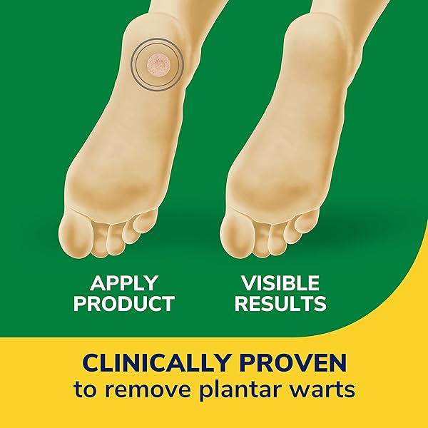 DR SCHOLL’S CLEAR AWAY PLANTAR WART REMOVER // 24 DISCS/24 CUSHIONS, CLINICALLY PROVEN, MAXIMUM STRENGTH WITHOUT A PRESCRIPTION, CUSHIONING PAD RELIEVES PAIN, 24 TREATMENTS