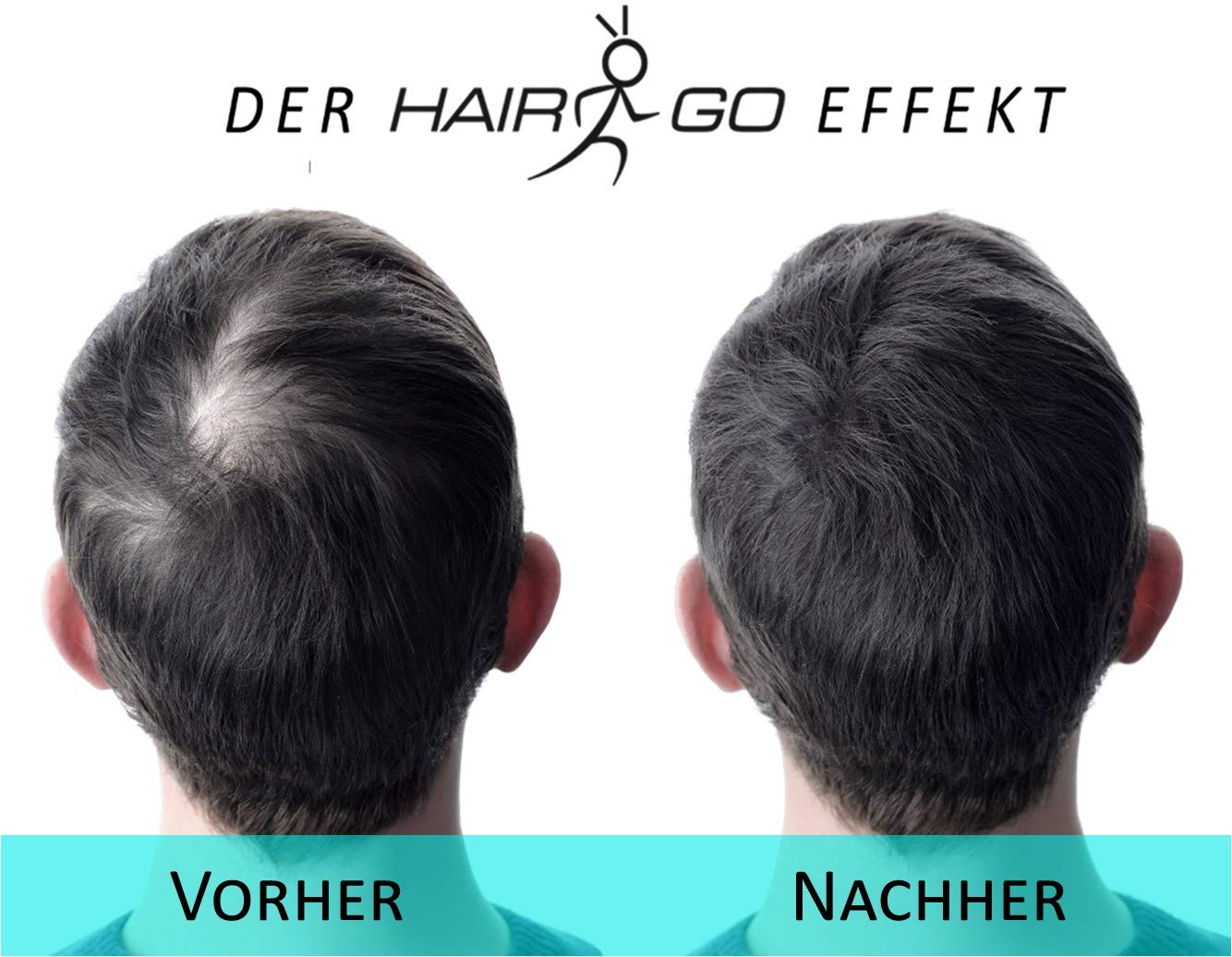 HAIR GO Premium Schütthaar zur Haarverdichtung | Haarpuder | Streuhaar | Haarauffüller | Haarausfall | Haarverdichter 100% natürlich & vegan, 1er Pack, (1x 25 gr.) (schwarz) 4