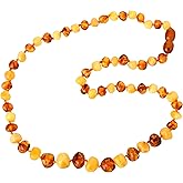 TheNaturalAmber Amber Necklace – Baltic Amber Baroque Beads 50cm, Polished Milky & Cognac, Handmade Amber Jewelry for Adults